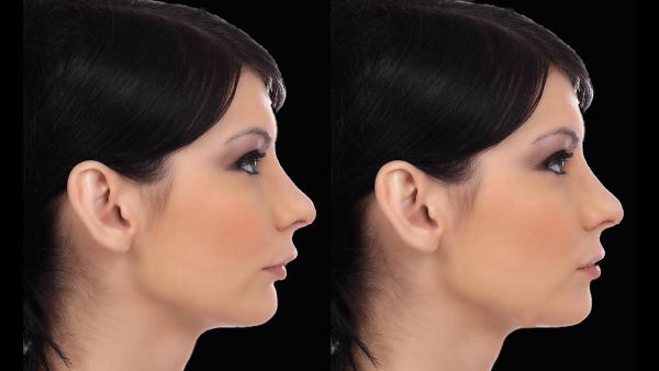 Simulation for jaw movements