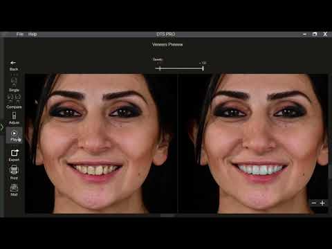 DTS Pro – #1 AI Dental Smile Simulation Software